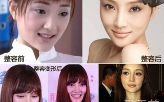 整容越整越丑的明星，整容越整越丑的明星有哪些